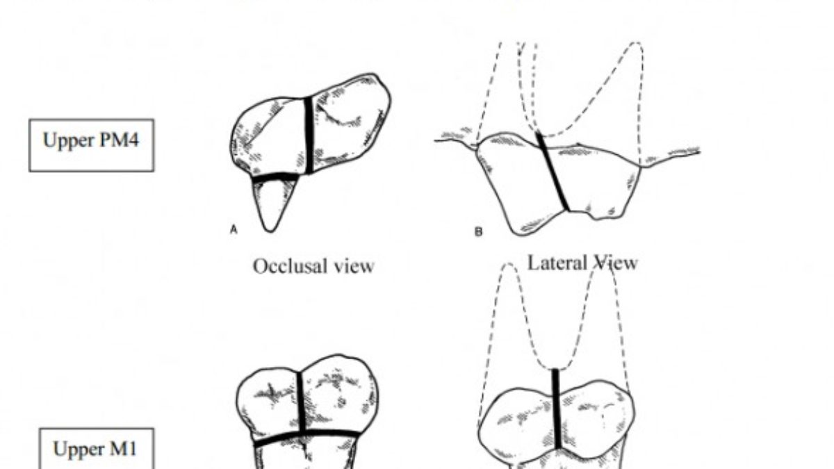 How Much To Extract A Dog Tooth